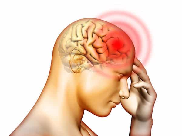 all kind of headache pain solutions